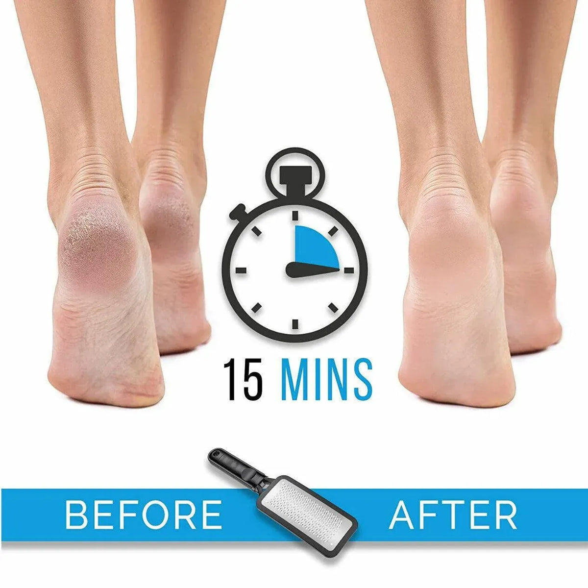 Stainless Steel Foot File Scraper Grater Pedicure Rasp Callus Remover Tool - White